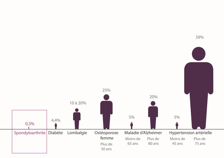 Spondylarthrite comparatif maladies