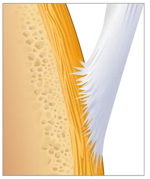 Schéma enthèse normale